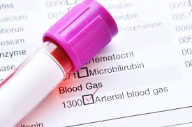 Arterial Blood Gas test