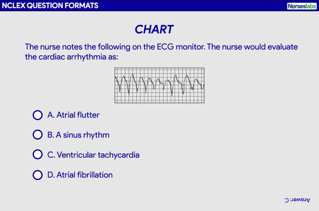 Chart question